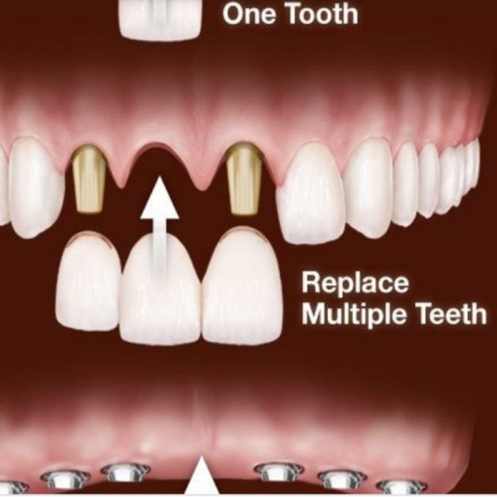 Procedure